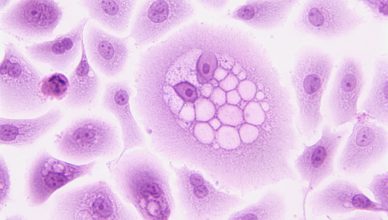 Imagen de una célula con microsopio